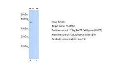 FAM46C Antibody, Novus Biologicals 100 &mu;L; Unconjugated:Antibodies,